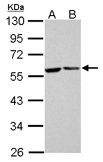 FKBP4 / FKBP52 Antibody - FKBP4 antibody detects FKBP4 protein by Western blot analysis. A. 30 ug GL261 whole cell lysate/extract. B. 30 ug C8D30 whole cell lysate/extract. 10 % SDS-PAGE. FKBP4 antibody dilution:1:1000