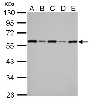 FKBP4 / FKBP52 Antibody - FKBP4 antibody detects FKBP4 protein by Western blot analysis. A. 30 ug 293T whole cell lysate/extract. B. 30 ug A431 whole cell lysate/extract. C. 30 ug HeLa whole cell lysate/extract. D. 30 ug HepG2 whole cell lysate/extract. E. 30 ug A375 whole cell lysate/extract. 10 % SDS-PAGE. FKBP4 antibody dilution:1:1000