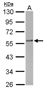 FKBP4 / FKBP52 Antibody - FKBP4 antibody detects FKBP4 protein by Western blot analysis. A. 30 ug Rat2 whole cell lysate/extract. 10 % SDS-PAGE. FKBP4 antibody dilution:1:1000
