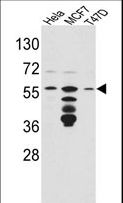 FKBP4 / FKBP52 Antibody - Western blot of FKBP4 Antibody in HeLa,MCF7,T47D cell line lysates(35 ug/lane). FKBP4(arrow) was detected using the purified antibody.