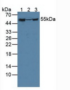 FKBP4 / FKBP52 Antibody - Western Blot; Sample: Lane1: Human K562 Cells; Lane2: Porcine Brain Tissue; Lane3: Porcine Kidney Tissue.