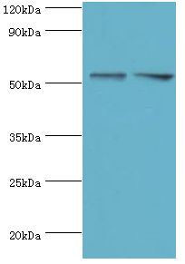 FKBP4 / FKBP52 Antibody - Western blot. All lanes: Peptidyl-prolyl cis-trans isomerase FKBP4 antibody at 1 ug/ml. Lane 1: HeLa whole cell lysate. Lane 2: MCF-7 whole cell lysate. secondary Goat polyclonal to rabbit at 1:10000 dilution. Predicted band size: 52 kDa. Observed band size: 52 kDa.