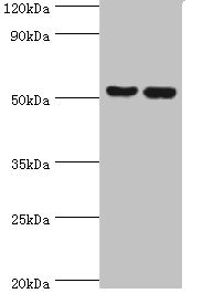 FKBP4 / FKBP52 Antibody - Western blot All lanes: Peptidyl-prolyl cis-trans isomerase FKBP4 antibody at 1µg/ml Lane 1: Hela whole cell lysate Lane 2: MCF-7 whole cell lysate Secondary Goat polyclonal to rabbit IgG at 1/10000 dilution Predicted band size: 52 kDa Observed band size: 52 kDa