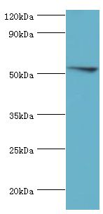 FKBP4 / FKBP52 Antibody - Western blot. All lanes: Peptidyl-prolyl cis-trans isomerase FKBP4 antibody at 0.5 ug/ml. Secondary antibody: Goat polyclonal to rabbit at 1:10000 dilution. Predicted band size: 52 kDa. Observed band size: 52 kDa Immunohistochemistry.