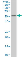 FKBP4 / FKBP52 Antibody - FKBP4 monoclonal antibody (M01), clone 5C11. Western blot of FKBP4 expression in NIH/3T3.