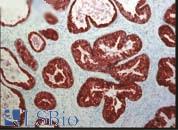 FKBP4 / FKBP52 Antibody - Prostate tissue was histologically stained with antibodies specific for FKBP52. The strongest staining for FKBP52 is in ductal epithelial cells.  This image was taken for the unconjugated form of this product. Other forms have not been tested.