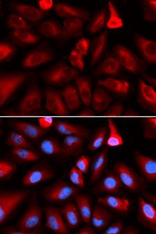 FKBP4 / FKBP52 Antibody - Immunofluorescence analysis of U20S cells.