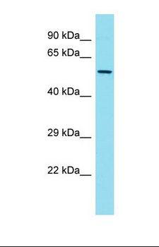 FKBP5 / FKBP51 Antibody - Western blot of Human Thymus Tumor. FKBP5 antibody dilution 1.0 ug/ml.  This image was taken for the unconjugated form of this product. Other forms have not been tested.