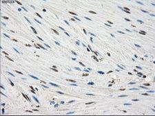 FKBP5 / FKBP51 Antibody - IHC of paraffin-embedded colon tissue using anti-FKBP5 mouse monoclonal antibody. (Dilution 1:50).