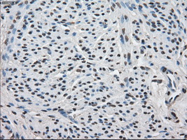FKBP5 / FKBP51 Antibody - IHC of paraffin-embedded endometrium tissue using anti-FKBP5 mouse monoclonal antibody. (Dilution 1:50).