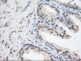 FKBP5 / FKBP51 Antibody - IHC of paraffin-embedded prostate tissue using anti-FKBP5 mouse monoclonal antibody. (Dilution 1:50).