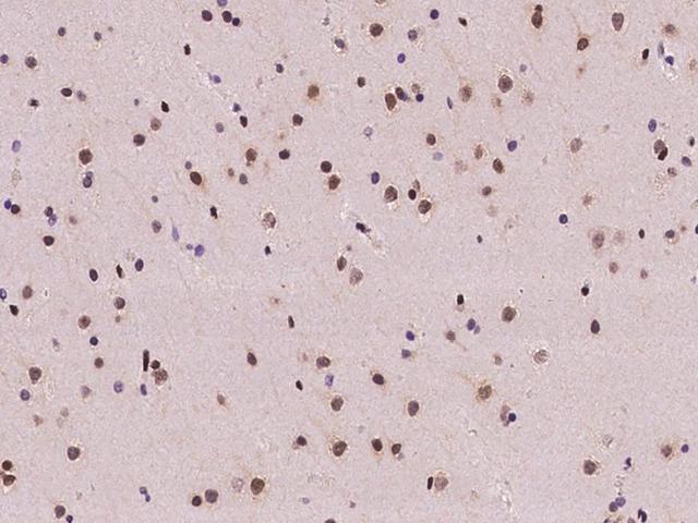 FKBP5 / FKBP51 Antibody - Immunochemical staining of human FKBP5 in human brain with rabbit polyclonal antibody at 1:100 dilution, formalin-fixed paraffin embedded sections.