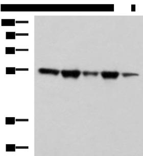 FKBP5 / FKBP51 Antibody - Western blot analysis of A172 Hela HepG2 K562 and PC3 cell lysates  using FKBP5 Polyclonal Antibody at dilution of 1:600