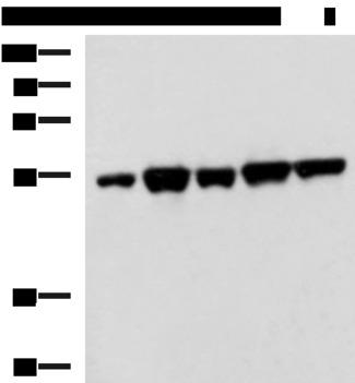 FKBP5 / FKBP51 Antibody - Western blot analysis of PC3 K562 HepG2 Hela A172 cell lysates  using FKBP5 Polyclonal Antibody at dilution of 1:600