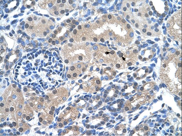 FKBP6 Antibody - FKBP6 antibody ARP43027_T100-NP_003593-FKBP6(FK506 binding protein 6, 36kDa) Antibody was used in IHC to stain formalin-fixed, paraffin-embedded human kidney.  This image was taken for the unconjugated form of this product. Other forms have not been tested.