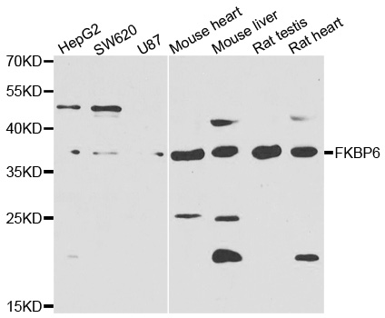 FKBP6 Antibody - Western blot analysis of extracts of various cell lines.