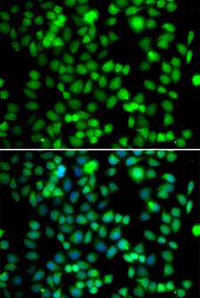 FKBP6 Antibody - Immunofluorescence analysis of U20S cells.