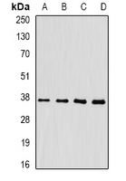 FKBP6 Antibody - Western blot analysis of FKBP6 expression in HepG2 (A); mouse heart (B); mouse liver (C); rat testis (D) whole cell lysates.