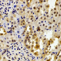 FKBP6 Antibody - Immunohistochemical analysis of FKBP6 staining in mouse kidney formalin fixed paraffin embedded tissue section. The section was pre-treated using heat mediated antigen retrieval with sodium citrate buffer (pH 6.0). The section was then incubated with the antibody at room temperature and detected using an HRP conjugated compact polymer system. DAB was used as the chromogen. The section was then counterstained with hematoxylin and mounted with DPX.