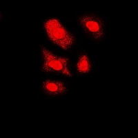 FKBP6 Antibody - Immunofluorescent analysis of FKBP6 staining in U2OS cells. Formalin-fixed cells were permeabilized with 0.1% Triton X-100 in TBS for 5-10 minutes and blocked with 3% BSA-PBS for 30 minutes at room temperature. Cells were probed with the primary antibody in 3% BSA-PBS and incubated overnight at 4 deg C in a humidified chamber. Cells were washed with PBST and incubated with a DyLight 594-conjugated secondary antibody (red) in PBS at room temperature in the dark.