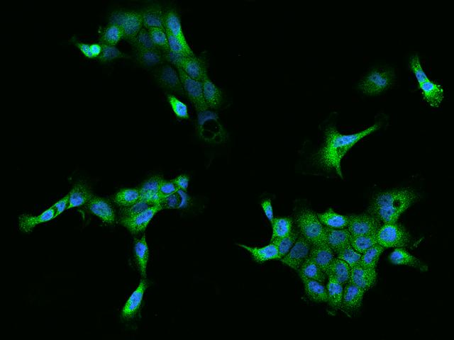 FKBP6 Antibody - Immunofluorescence staining of FKBP6 in A431 cells. Cells were fixed with 4% PFA, permeabilzed with 0.1% Triton X-100 in PBS, blocked with 10% serum, and incubated with rabbit anti-Human FKBP6 polyclonal antibody (dilution ratio 1:200) at 4°C overnight. Then cells were stained with the Alexa Fluor 488-conjugated Goat Anti-rabbit IgG secondary antibody (green) and counterstained with DAPI (blue). Positive staining was localized to Cytoplasm.