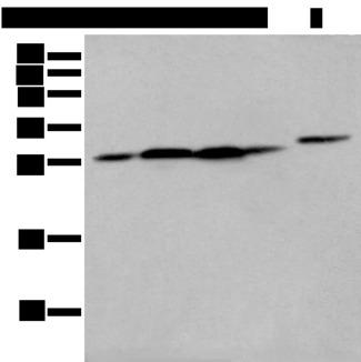 FKBP7 Antibody - Western blot analysis of 293T cell Human fetal liver tissue A549 and Hepg2 cell  using FKBP7 Polyclonal Antibody at dilution of 1:400