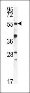 FKBP9 Antibody - Western blot of FKBP9 antibody in mouse kidney tissue lysates (35 ug/lane). FKBP9 (arrow) was detected using the purified antibody.
