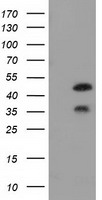 FKBPL Antibody - HEK293T cells were transfected with the pCMV6-ENTRY control (Left lane) or pCMV6-ENTRY FKBPL (Right lane) cDNA for 48 hrs and lysed. Equivalent amounts of cell lysates (5 ug per lane) were separated by SDS-PAGE and immunoblotted with anti-FKBPL.