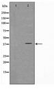 FKBPL Antibody - Western blot of Jurkat cell lysate using FKBPL Antibody