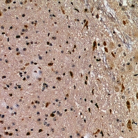 FKBPL Antibody - Immunohistochemical analysis of FKBPL staining in human brain formalin fixed paraffin embedded tissue section. The section was pre-treated using heat mediated antigen retrieval with sodium citrate buffer (pH 6.0). The section was then incubated with the antibody at room temperature and detected using an HRP conjugated compact polymer system. DAB was used as the chromogen. The section was then counterstained with haematoxylin and mounted with DPX.
