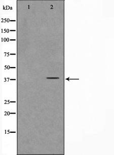 FKBPL Antibody - Western blot analysis on Jurkat cell lysates using FKBPL antibody