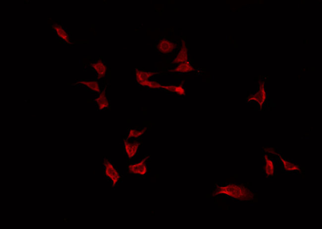 FKBPL Antibody - Staining HeLa cells by IF/ICC. The samples were fixed with PFA and permeabilized in 0.1% Triton X-100, then blocked in 10% serum for 45 min at 25°C. The primary antibody was diluted at 1:200 and incubated with the sample for 1 hour at 37°C. An Alexa Fluor 594 conjugated goat anti-rabbit IgG (H+L) Ab, diluted at 1/600, was used as the secondary antibody.