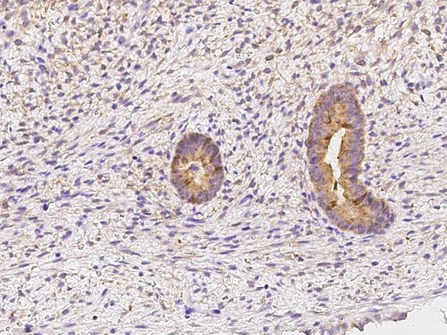 FKBPL Antibody - Immunochemical staining of human FKBPL in human corpus uteri with rabbit polyclonal antibody at 1:200 dilution, formalin-fixed paraffin embedded sections.