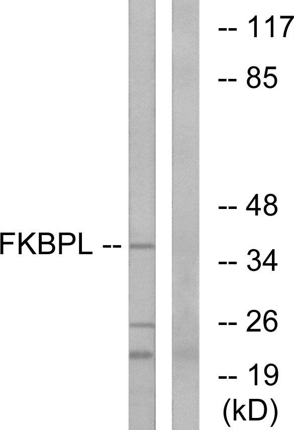 FKBPL Antibody - Western blot analysis of extracts from Jurkat cells, using FKBPL antibody.