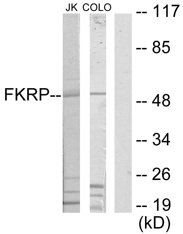 FKRP Antibody - Western blot analysis of lysates from Jurkat and COLO205 cells, using FKRP Antibody. The lane on the right is blocked with the synthesized peptide.