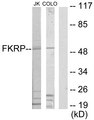 FKRP Antibody - Western blot analysis of lysates from Jurkat and COLO205 cells, using FKRP Antibody. The lane on the right is blocked with the synthesized peptide.