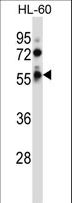 FKRP Antibody - FKRP Antibody western blot of HL-60 cell line lysates (35 ug/lane). The FKRP antibody detected the FKRP protein (arrow).