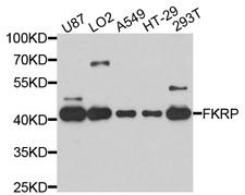 FKRP Antibody - Western blot analysis of extracts of various cell lines, using FKRP antibody at 1:1000 dilution. The secondary antibody used was an HRP Goat Anti-Rabbit IgG (H+L) at 1:10000 dilution. Lysates were loaded 25ug per lane and 3% nonfat dry milk in TBST was used for blocking. An ECL Kit was used for detection and the exposure time was 5s.