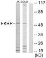FKRP Antibody - Western blot analysis of extracts from Jurkat cells and COLO205 cells, using FKRP antibody.