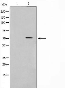 FKRP Antibody - Western blot analysis on Jurkat cell lysates using FKRP antibody. The lane on the left is treated with the antigen-specific peptide.