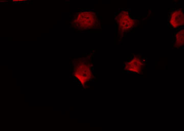 FKRP Antibody - Staining HeLa cells by IF/ICC. The samples were fixed with PFA and permeabilized in 0.1% Triton X-100, then blocked in 10% serum for 45 min at 25°C. The primary antibody was diluted at 1:200 and incubated with the sample for 1 hour at 37°C. An Alexa Fluor 594 conjugated goat anti-rabbit IgG (H+L) Ab, diluted at 1/600, was used as the secondary antibody.