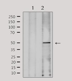 FKRP Antibody - Western blot analysis of extracts of HeLa cells using FKRP antibody. Lane 1 was treated with the antigen-specific peptide.
