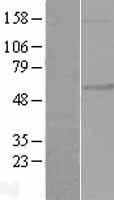 FKRP Protein - Western validation with an anti-DDK antibody * L: Control HEK293 lysate R: Over-expression lysate