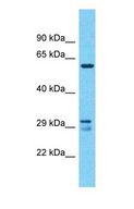 FKSG40 / KAZALD1 Antibody - Western blot of KAZALD1 Antibody with U937 Whole cell lysate.  This image was taken for the unconjugated form of this product. Other forms have not been tested.