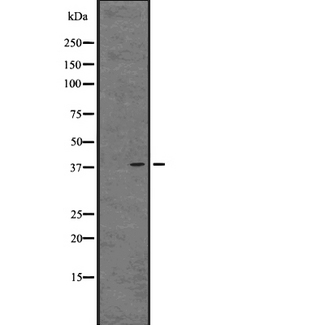 FKSG80 / GPR81 Antibody - Western blot analysis of GPR81 expression in 293 cells line lysate. The lane on the left is treated with the antigen-specific peptide.