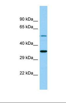 FKSG89 / MBOAT4 Antibody - Western blot of Human MDA-MB-435S. MBOAT4 antibody dilution 1.0 ug/ml.  This image was taken for the unconjugated form of this product. Other forms have not been tested.