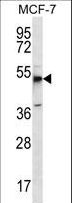 FKSG89 / MBOAT4 Antibody - MBOAT4 Antibody western blot of MCF-7 cell line lysates (35 ug/lane). The MBOAT4 antibody detected the MBOAT4 protein (arrow).