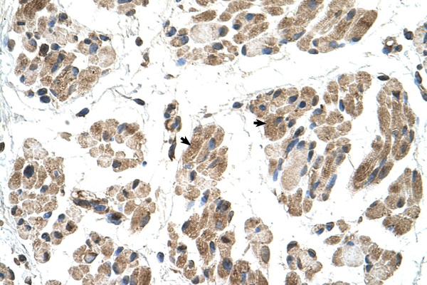 FKTN / Fukutin Antibody - FKTN / Fukutin antibody ARP45033_T100-NP_001073270-FKTN Antibody IHC of formalin-fixed, paraffin-embedded human Muscle. Positive label: Skeletal muscle cells indicated with arrows. Antibody concentration 4-8 ug/ml. Magnification 400X.  This image was taken for the unconjugated form of this product. Other forms have not been tested.