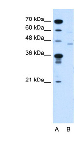 FKTN / Fukutin Antibody - FKTN / Fukutin antibody ARP45033_T100-NP_001073270-FKTN Antibody Western blot of Jurkat lysate.  This image was taken for the unconjugated form of this product. Other forms have not been tested.