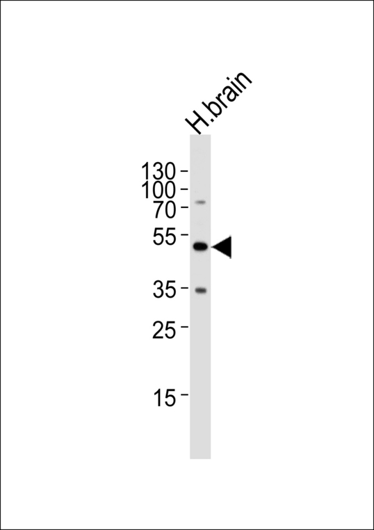 FKTN / Fukutin Antibody - Western blot of lysate from human brain tissue lysate, using FKTN Antibody. Antibody was diluted at 1:1000 at each lane. A goat anti-rabbit IgG H&L (HRP) at 1:5000 dilution was used as the secondary antibody. Lysate at 35ug per lane.